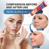 Крем против заболеваний кожи Sumifun Skin Tag Removal Cream 20g (106)