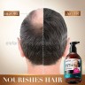 Шампунь для повреждённых волос SADOER Anti Hair Loss Repair Nourish 300ml (13)