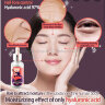 Сыворотка Elizavecca Witch Piggy Hell Pore Control Hyaluronic Acid 97%, 50 мл (78)
