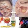 Спрей от заболеваний носа Nasal Spray 20ml (106)