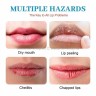 Крем для восстановления губ OUHOE Cheilitis Treatment Cream 20g (106)