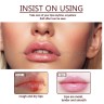 Крем для восстановления губ EELHOE Cheilitis Cold Sores Lip Treatment Cream 20g (106)
