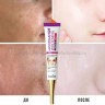 Отбеливающий крем для лица Sadoer Whitening Freckle Face Cream 20g (106)